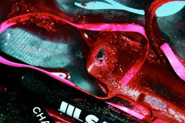 Jangan Tinggalkan 5 Benda Ini Di Mobil, Bahaya! 